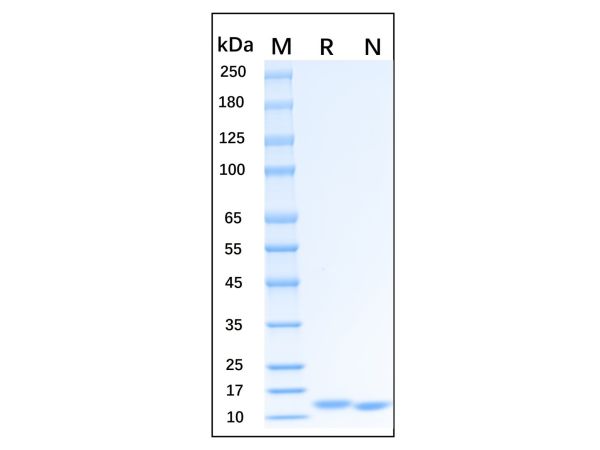 aladdin 阿拉丁 rp155067 Recombinant Rat GM-CSF Protein Animal Free, ＞98% (SDS-PAGE, HPLC), Active, E. coli, No tag, 18-144 aa