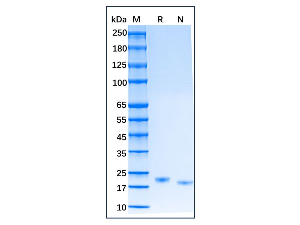aladdin 阿拉丁 rp155124 Recombinant Rat IL-6 Protein Animal free, >96% (SDS-PAGE, HPLC), Active, E. coli, No tag, 25-211 aa