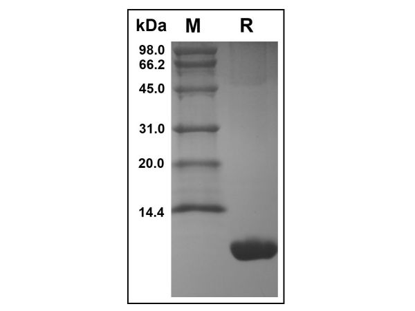 aladdin 阿拉丁 rp168795 Recombinant Mouse CXCL1/KC Protein Animal Free, >97%(SDS-PAGE and HPLC), Active, E.coli, No tag, 25-96 aa