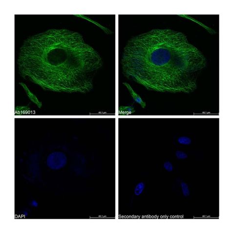 aladdin 阿拉丁 Ab169013 alpha Tubulin Mouse mAb mAb (CD03/1G2); Mouse anti human alpha tubulin Antibody; WB, Flow, ICC/IF, ELISA; Unconjugated