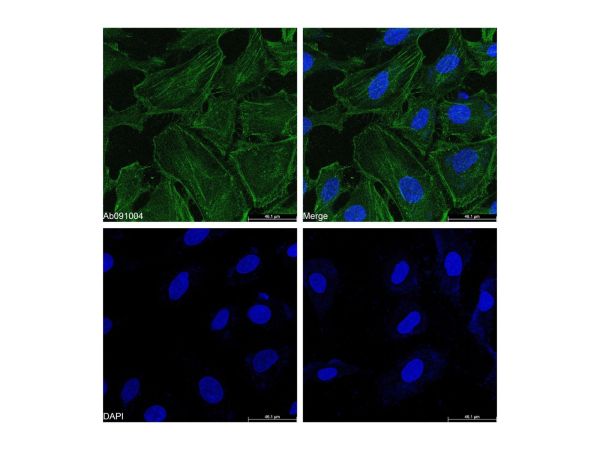 aladdin 阿拉丁 Ab170148 Goat Anti-Rabbit IgG H&L (FITC) Secondary Antibody; Goat Anti-Rabbit IgG H&L (FITC); IF, Flow
