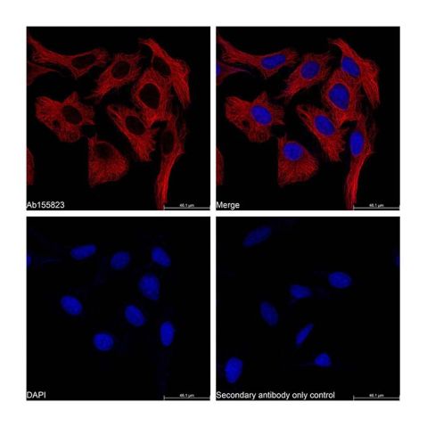 aladdin 阿拉丁 Ab179005 Goat Anti-Mouse IgG H&L (TRITC) Secondary Antibody; Goat Anti-Mouse IgG H&L (TRITC); IF, Flow