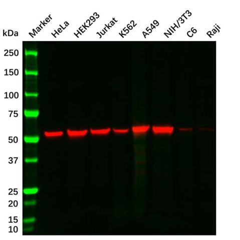 aladdin 阿拉丁 Ab179919 Vimentin Mouse mAb mAb (AB08/4A9); Mouse anti Vimentin Antibody; WB, Flow, ICC/IF, ELISA; Unconjugated