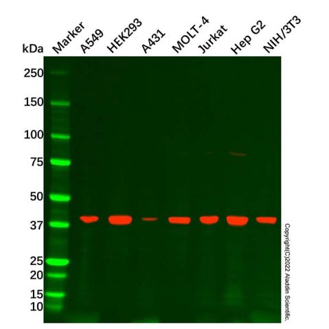 aladdin 阿拉丁 Ab087103 ACAT1 Antibody pAb; Rabbit anti Human ACAT1 Antibody; WB, IHC, IF, ICC; Unconjugated