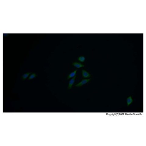 aladdin 阿拉丁 Ab087103 ACAT1 Antibody pAb; Rabbit anti Human ACAT1 Antibody; WB, IHC, IF, ICC; Unconjugated