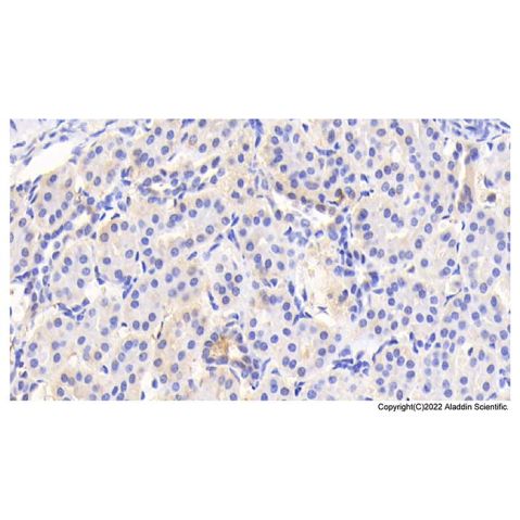 aladdin 阿拉丁 Ab087103 ACAT1 Antibody pAb; Rabbit anti Human ACAT1 Antibody; WB, IHC, IF, ICC; Unconjugated