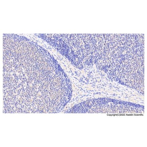 aladdin 阿拉丁 Ab087103 ACAT1 Antibody pAb; Rabbit anti Human ACAT1 Antibody; WB, IHC, IF, ICC; Unconjugated