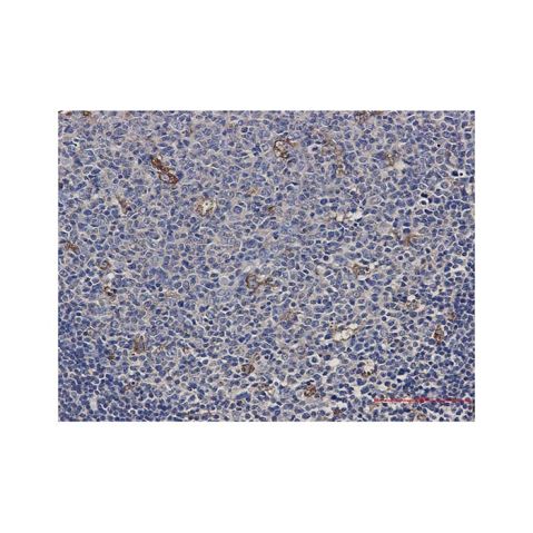 aladdin 阿拉丁 Ab090162 Recombinant ATP6V1A Antibody Validated, 0.8 mg/mL