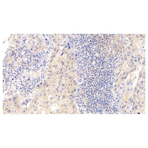 aladdin 阿拉丁 Ab095764 Cdk4 Antibody pAb; Rabbit anti Human Cdk4 Antibody; WB, IHC; Unconjugated