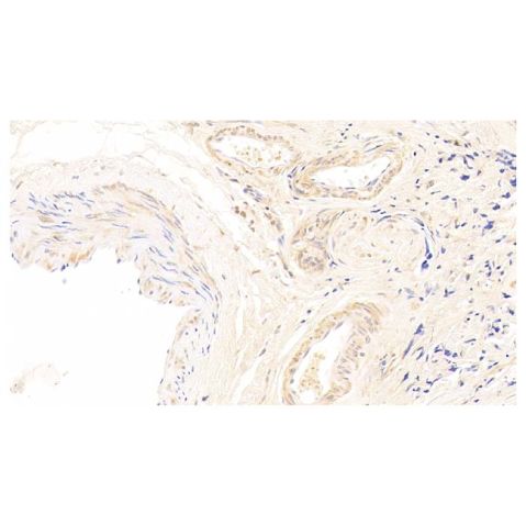 aladdin 阿拉丁 Ab095764 Cdk4 Antibody pAb; Rabbit anti Human Cdk4 Antibody; WB, IHC; Unconjugated