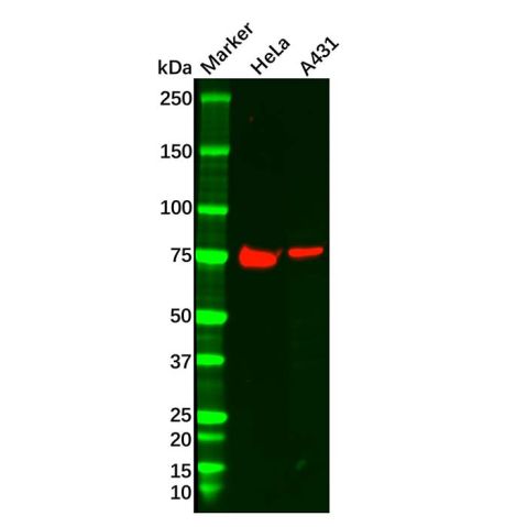 aladdin 阿拉丁 Ab099911 Dishevelled/Dvl1 Antibody pAb; Rabbit anti Human Dishevelled/Dvl1 Antibody; WB, IHC; Unconjugated