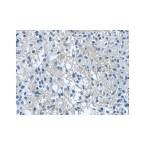 aladdin 阿拉丁 Ab099911 Dishevelled/Dvl1 Antibody pAb; Rabbit anti Human Dishevelled/Dvl1 Antibody; WB, IHC; Unconjugated