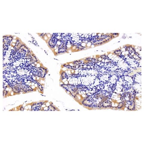 aladdin 阿拉丁 Ab099911 Dishevelled/Dvl1 Antibody pAb; Rabbit anti Human Dishevelled/Dvl1 Antibody; WB, IHC; Unconjugated