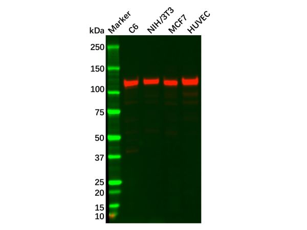 aladdin 阿拉丁 Ab102794 FAK Antibody pAb; Rabbit anti Human FAK Antibody; WB, IHC; Unconjugated