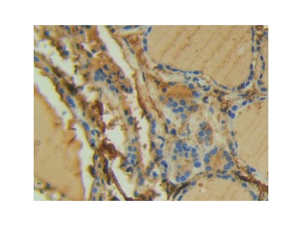 aladdin 阿拉丁 Ab102794 FAK Antibody pAb; Rabbit anti Human FAK Antibody; WB, IHC; Unconjugated