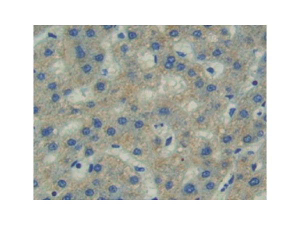 aladdin 阿拉丁 Ab102794 FAK Antibody pAb; Rabbit anti Human FAK Antibody; WB, IHC; Unconjugated