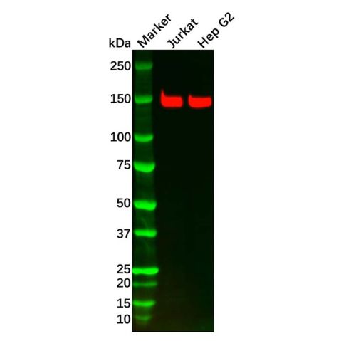 aladdin 阿拉丁 Ab103359 Recombinant FGFR2 Antibody Recombinant (R01-3I4); Rabbit anti Human FGFR2 Antibody; WB; Unconjugated
