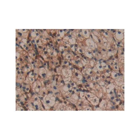 aladdin 阿拉丁 Ab104554 Galectin 1 Antibody pAb; Rabbit anti Human Galectin 1 Antibody; WB, IHC; Unconjugated