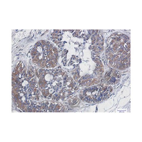 aladdin 阿拉丁 Ab117948 Recombinant NF-kB p65 Antibody Recombinant (R09-3H2); Rabbit anti Human NF- kB p65 Antibody; WB, IHC; Unconjugated