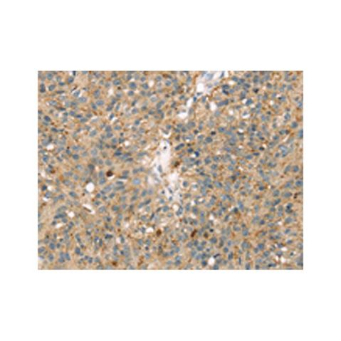 aladdin 阿拉丁 Ab119728 p38 gamma/MAPK12 Antibody pAb; Rabbit anti Human p38 gamma/MAPK12 Antibody; WB, IHC; Unconjugated