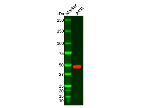aladdin 阿拉丁 Ab134765 Recombinant Wnt5a Antibody Recombinant (R08-4A3); Rabbit anti Human Wnt5a Antibody; WB, ICC, IF; Unconjugated
