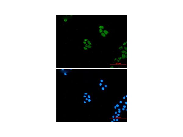 aladdin 阿拉丁 Ab134765 Recombinant Wnt5a Antibody Recombinant (R08-4A3); Rabbit anti Human Wnt5a Antibody; WB, ICC, IF; Unconjugated