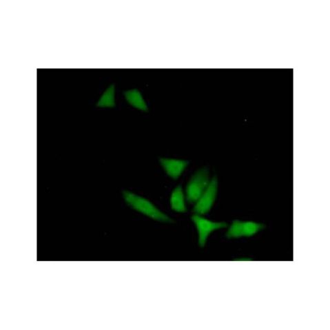 aladdin 阿拉丁 Ab134877 XIAP Antibody pAb; Rabbit anti Human XIAP Antibody; WB, IHC, IF, ICC; Unconjugated