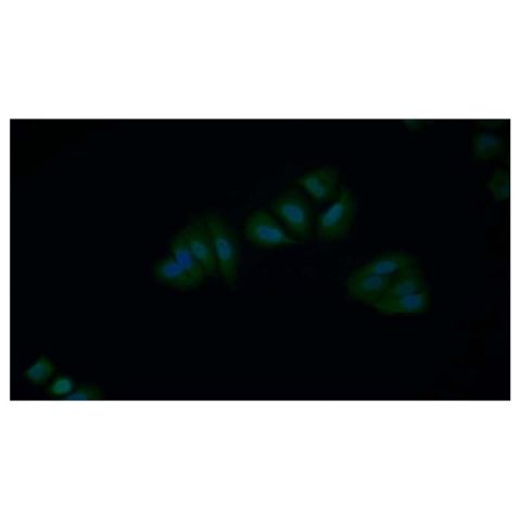 aladdin 阿拉丁 Ab134877 XIAP Antibody pAb; Rabbit anti Human XIAP Antibody; WB, IHC, IF, ICC; Unconjugated