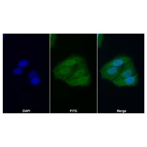 aladdin 阿拉丁 Ab134877 XIAP Antibody pAb; Rabbit anti Human XIAP Antibody; WB, IHC, IF, ICC; Unconjugated