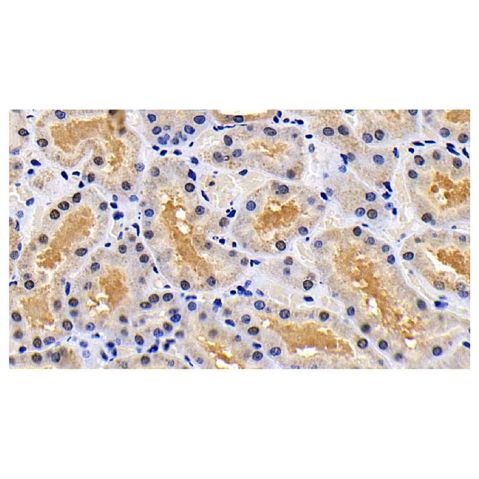 aladdin 阿拉丁 Ab134877 XIAP Antibody pAb; Rabbit anti Human XIAP Antibody; WB, IHC, IF, ICC; Unconjugated