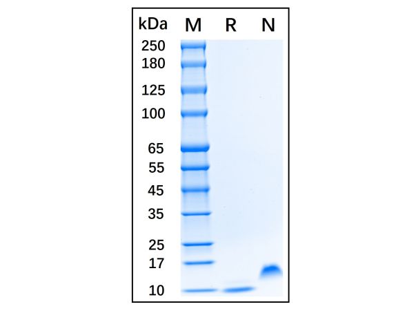 aladdin 阿拉丁 rp143234 Recombinant Human beta-Defensin 1 Protein Animal Free, >98%(SDS-PAGE, HPLC), Active, E.coli, No tag, 22-68 aa