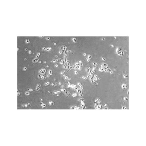 aladdin 阿拉丁 rp144473 Recombinant Human Clusterin Protein Animal Free, >90%(SDS-PAGE), Active, 293F, His tag, 23-449 aa