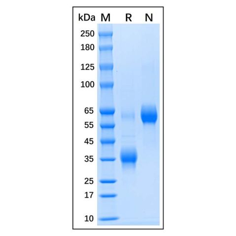 aladdin 阿拉丁 rp144473 Recombinant Human Clusterin Protein Animal Free, >90%(SDS-PAGE), Active, 293F, His tag, 23-449 aa