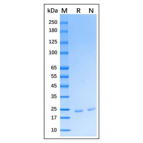 aladdin 阿拉丁 rp146650 Recombinant Human Gremlin 1 Protein Carrier Free, >98%(SDS-PAGE), Active, E.coli, His, 26-184 aa