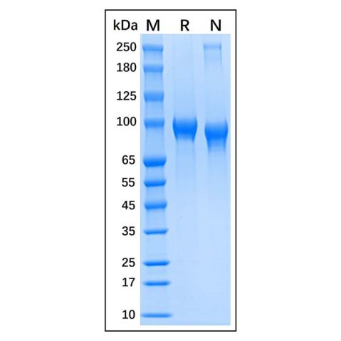 aladdin 阿拉丁 rp148898 Recombinant Human MMP9 Protein Animal Free, >95%(SDS-PAGE), Active, HEK293 cells, His tag, 20-707 aa