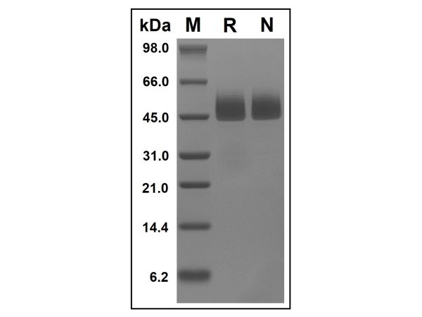 aladdin 阿拉丁 rp149226 Recombinant Human Neuroserpin Protein Animal Free, >95%(SDS-PAGE and HPLC), Active, E.coli, No tag, 17-410 aa