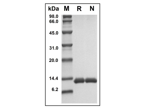 aladdin 阿拉丁 rp151452 Recombinant Human Serum Amyloid A Protein Animal Free, >98%(SDS-PAGE,HPLC), Active, E.coli, No tag, 19-122 aa