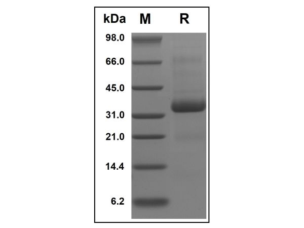 aladdin 阿拉丁 rp151779 Recombinant Human SPARC Protein Animal Free, >98% (SDS-PAGE, HPLC), Active, E.coli, No tag, 18-303 aa