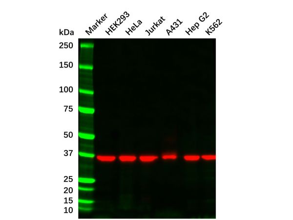 aladdin 阿拉丁 Ab155825 GAPDH Mouse mAb mAb (B08/4A11); Mouse anti Human GAPDH Antibody; WB, Flow, ICC/IF, ELISA; Unconjugated