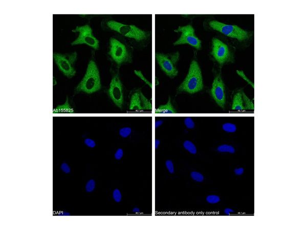 aladdin 阿拉丁 Ab155825 GAPDH Mouse mAb mAb (B08/4A11); Mouse anti Human GAPDH Antibody; WB, Flow, ICC/IF, ELISA; Unconjugated