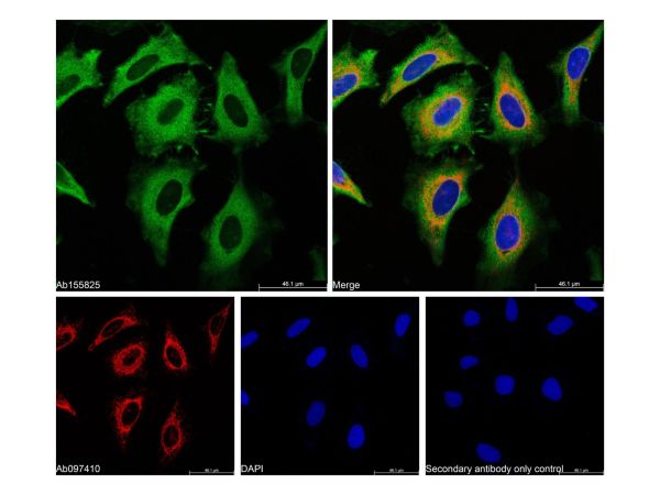 aladdin 阿拉丁 Ab155825 GAPDH Mouse mAb mAb (B08/4A11); Mouse anti Human GAPDH Antibody; WB, Flow, ICC/IF, ELISA; Unconjugated