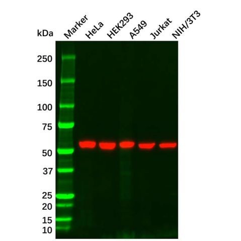 aladdin 阿拉丁 Ab156188 Vimentin Mouse mAb mAb (AB10/4F11); Mouse anti Vimentin Antibody; WB, Flow, ICC/IF, ELISA; Unconjugated