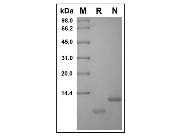 aladdin 阿拉丁 rp153061 Recombinant Human Uteroglobin Protein Animal Free, >98%(SDS-PAGE and HPLC), Active, E.coli, No tag, 22-91 aa