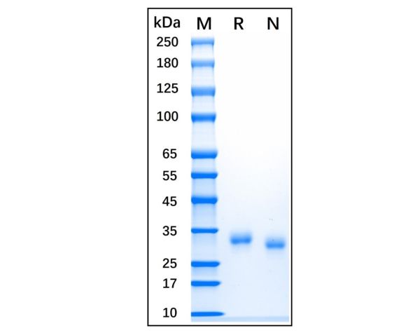 aladdin 阿拉丁 rp153094 Recombinant Human VCAM1 Protein Carrier Free, >92% (SDS-PAGE), Active, 293F, N-His tag,109-318 aa