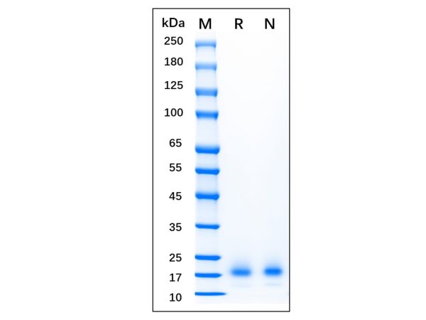 aladdin 阿拉丁 rp154228 Recombinant Mouse IL-4 Protein GMP, >95% (SDS-PAGE), Active, HEK 293, His,  21-140 aa