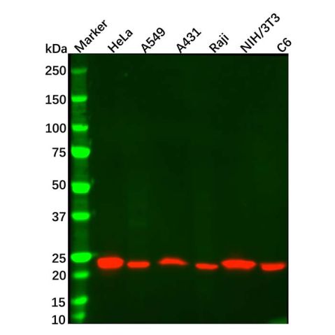 aladdin 阿拉丁 Ab156196 TAGLN Mouse mAb mAb (AB04/4H10); Mouse anti TAGLN Antibody; WB, Flow, ICC/IF, ELISA; Unconjugated