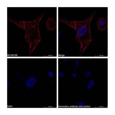 aladdin 阿拉丁 Ab156196 TAGLN Mouse mAb mAb (AB04/4H10); Mouse anti TAGLN Antibody; WB, Flow, ICC/IF, ELISA; Unconjugated
