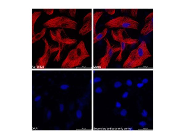 aladdin 阿拉丁 Ab156257 Goat Anti-Mouse IgG H&L (Cy5) Secondary Antibody; Goat Anti-Mouse IgG H&L (Cy5); IF, Flow