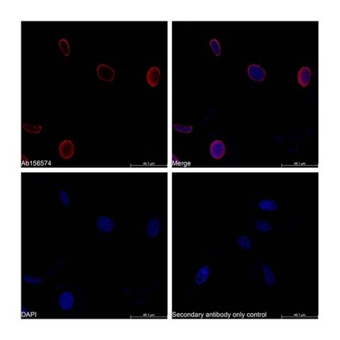 aladdin 阿拉丁 Ab156574 Histone H4 Mouse mAb mAb (CD01/2H7); Mouse anti Vinculin Antibody; WB, ICC/IF, ELISA; Unconjugated
