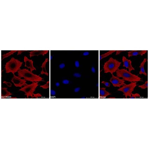 aladdin 阿拉丁 Ab176323 beta Actin Mouse mAb (TRITC) mAb (FG01/2D10); Mouse anti Human beta actin Antibody; IF; TRITC